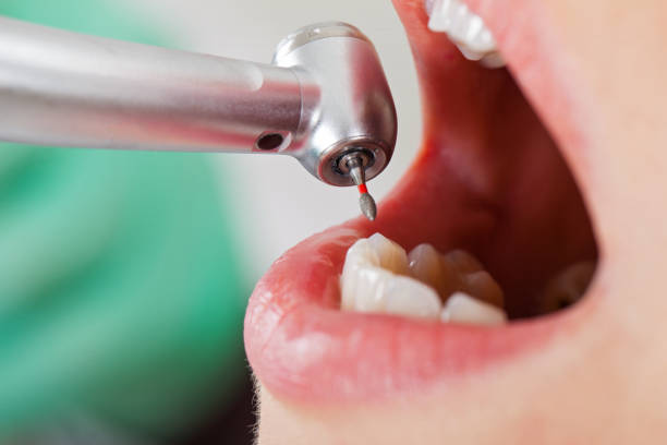 Best Emergency Dentist for Knocked-Out Tooth in Blythewood, SC